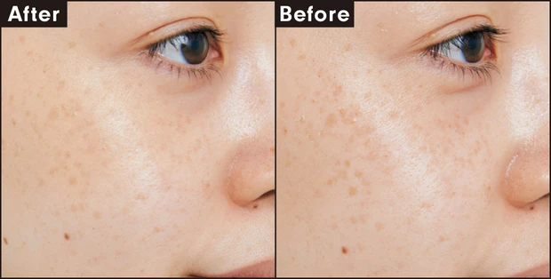 THREE ラディアントワンドインヴィジブル 02 カバー力を検証