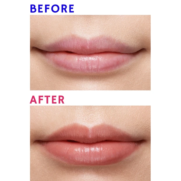 【悩み】唇の赤みが強い