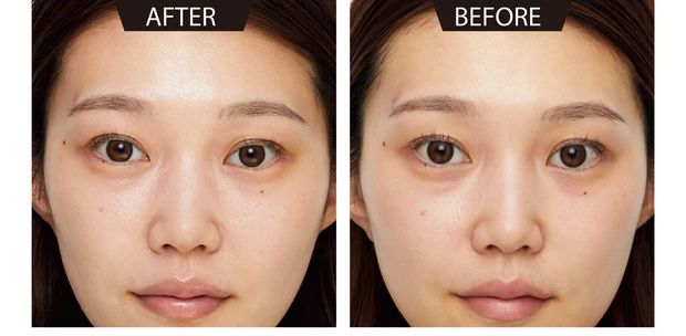 なめらか本舗 薬用リンクルアイクリーム ホワイトでノーマークだった涙袋の下のくすみが消滅