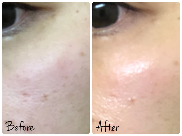 人気の化粧水【イプサ タイムRアクア】2周間つかってみました!_2