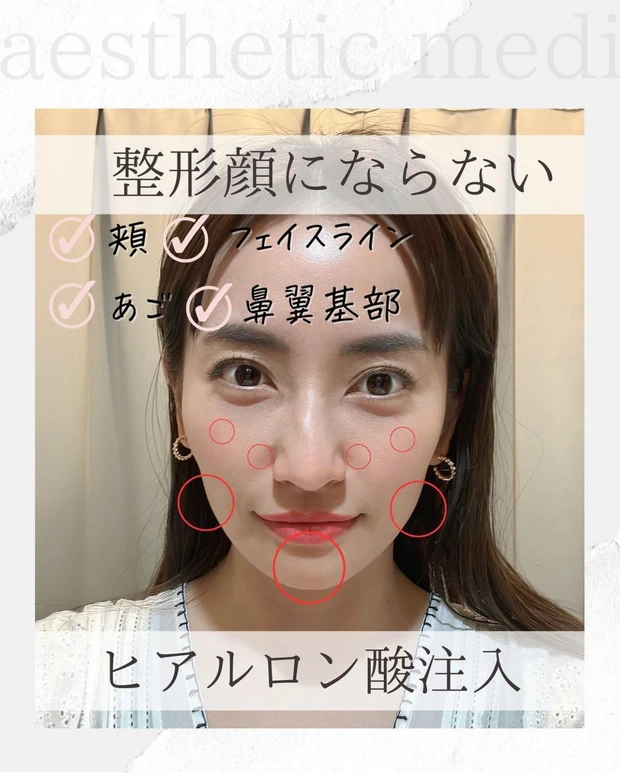 「美容皮膚科」と「美容外科」の違いについて解説します！_4_1