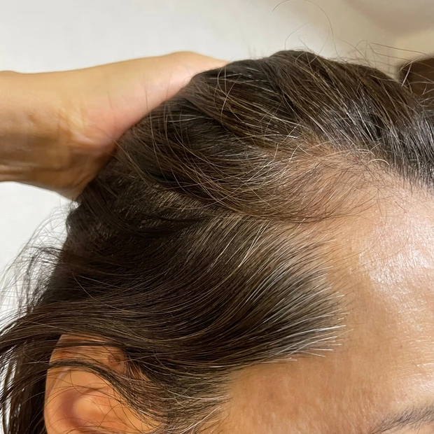 LPLP(ルプルプ)の【白髪染がめできるトリートメント】実際どうなの！？生え際のしぶとい白髪に使ってみた。_2_1