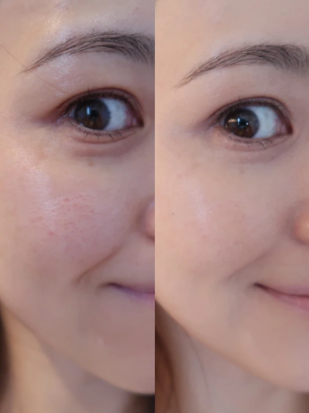 【スキンケアの最後に塗るだけ！弱バリア肌を24時間保護するバーム】フイルナチュラント エクスバリア プロテクトリペアバーム_4_3