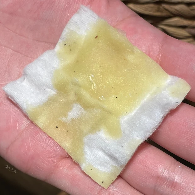 【30代以上必見👀】目に油を注ぐ!? インド伝承のネトラバスティ体験してきた📝´-_4