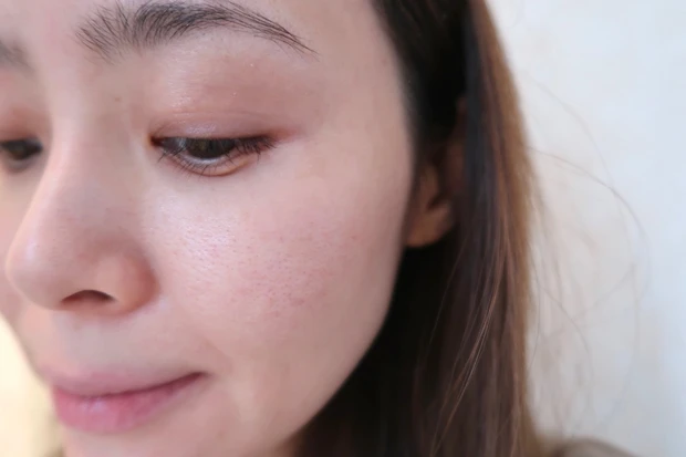 【ドクターズコスメを組み合わせた超美白ケア】_10_3