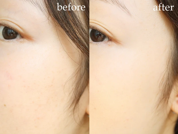 ケイト バーチャルスキンメイカー