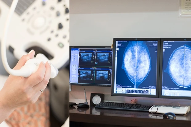 乳がんから守るために今できること