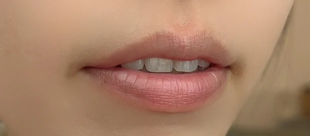 ぽってり唇　オーバーリップ　メイク