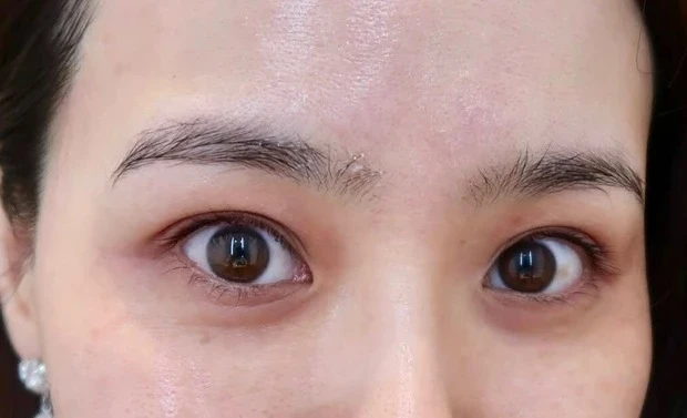 【目のクマの消し方】インフルエンサーおすすめのクマに効くアイケアは?_クマの改善を期待できるドクターズコスメ_1