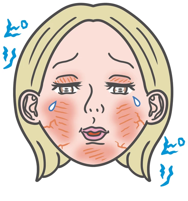 敏感肌とは、バリア機能低下によって刺激に過敏に反応してしまう肌のこと