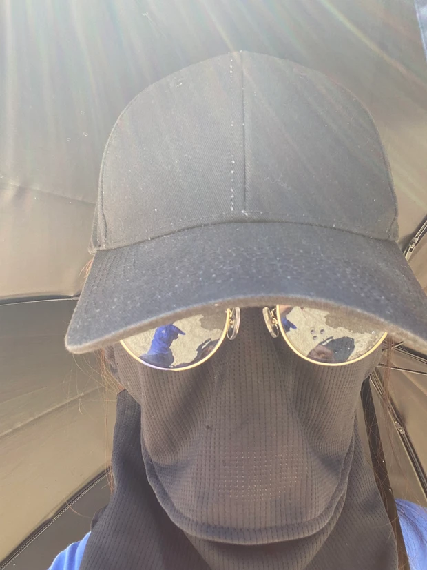 夏の紫外線、48時間以内が勝負！美肌のための緊急ケア術_4