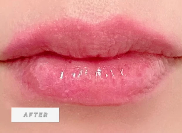 超話題!【VTリードルショット リップ プランパー】痛いの⁈塗った瞬間、ぷるん!【使用感レビュー】_4_2