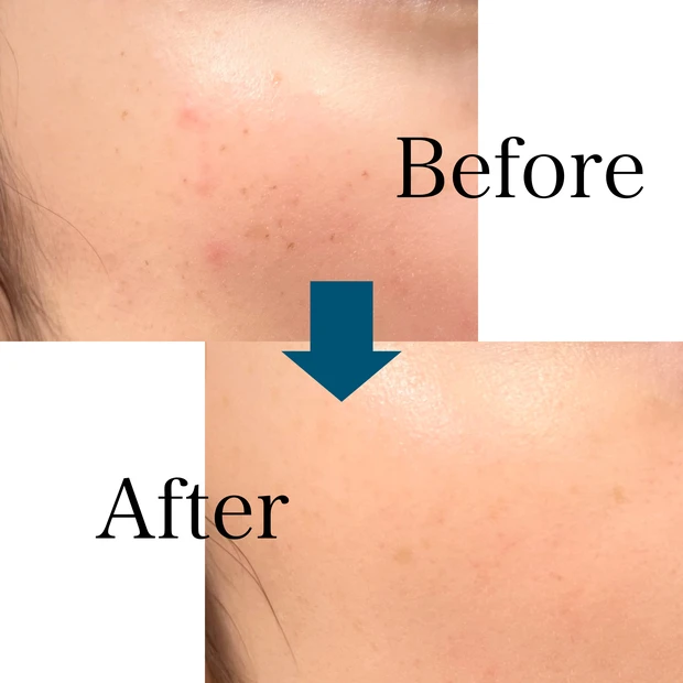 【自己紹介】コスメ大好きOL♡2024年度マキアインフルエンサーのpippiです♡_3