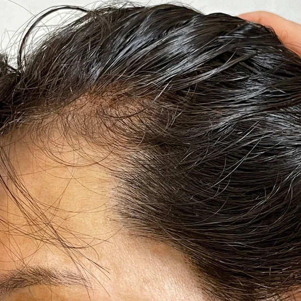 LPLP(ルプルプ)の【白髪染がめできるトリートメント】実際どうなの！？生え際のしぶとい白髪に使ってみた。_1_2