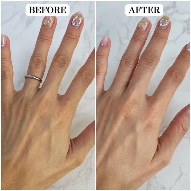 保湿 手袋 キュレル 効果