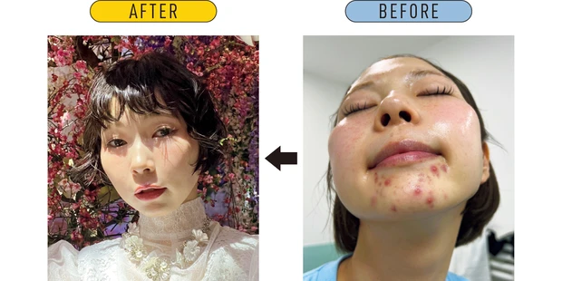 漫画で読める美肌挽回ストーリー＆おすすめコスメ PhotoGallery_4_3