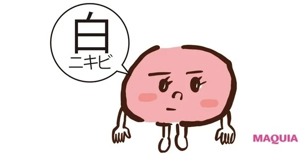 白ニキビとは