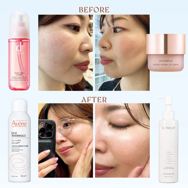 【しぼみ毛穴ケアコスメ５選】30日間使ったらここまで変わった！体験ルポ