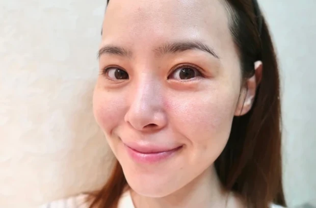 【超美白内服】私の肌は内服で作る！_6_1