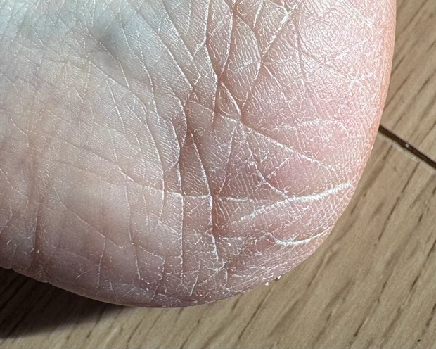 【ボディスクラブ】意外な使い方？！足の角質ケアもおすすめ_2_1