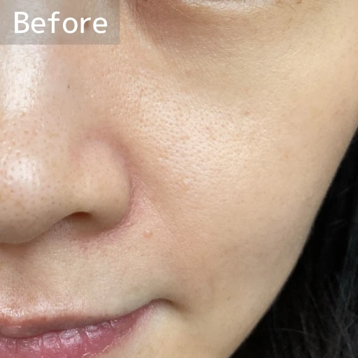 毛穴ケアの新常識！コスメデコルテから誕生した「AQ 毛穴美容液オイル」の実力とは？？_4_1