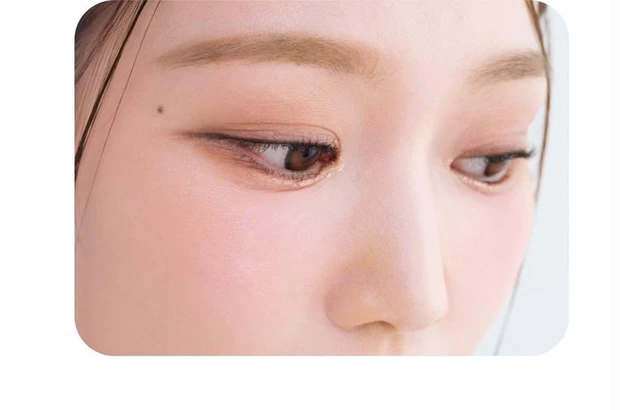 EYE-2