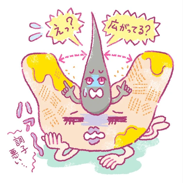 毛穴 開き
