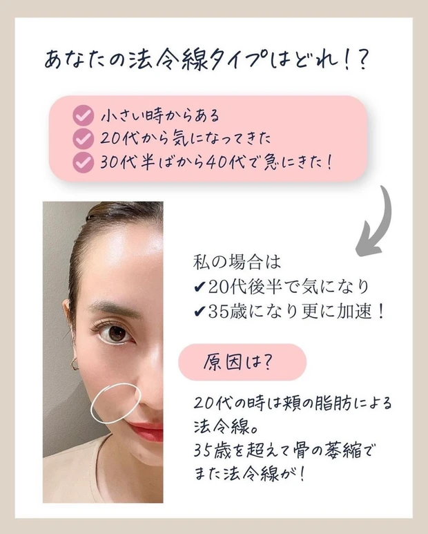 法令線治療_美容医療_AYAMI