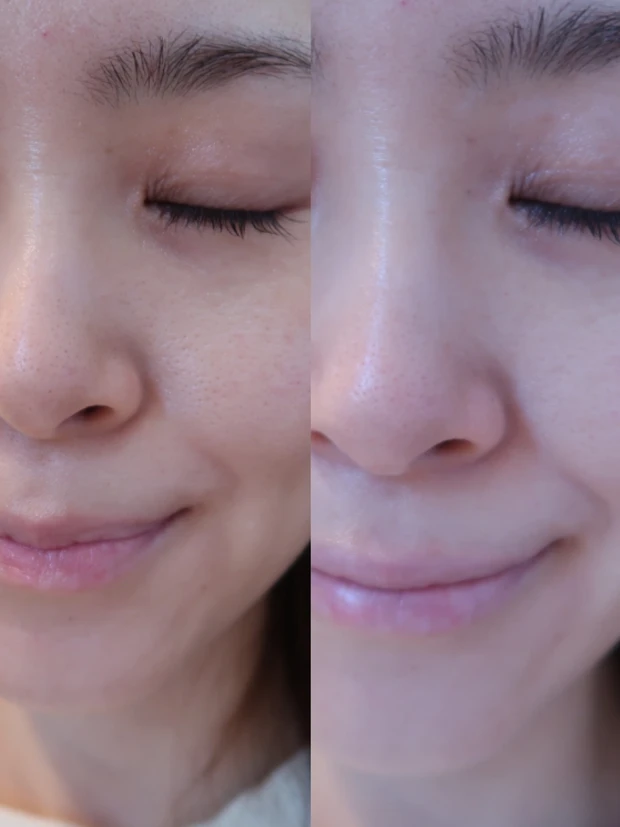 【スキンケアの最後に塗るだけ！弱バリア肌を24時間保護するバーム】フイルナチュラント エクスバリア プロテクトリペアバーム_3_3