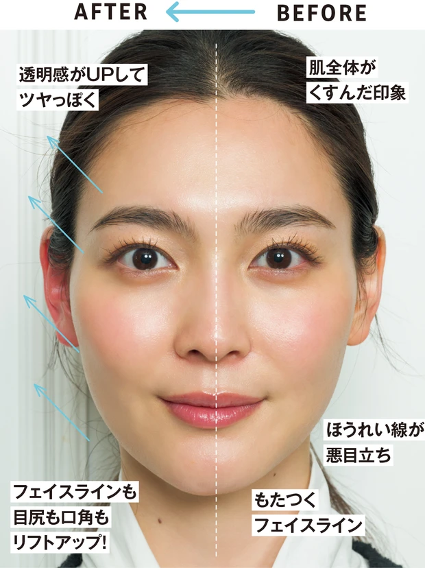 ［BEFORE］肌全体がくすんだ印象　ほうれい線が悪目立ち　もたつくフェイスライン　［AFTER］透明感がUPしてツヤっぽく　フェイスラインも目尻も口角もリフトアップ！