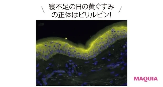 40代・アラフォーにおすすめのスキンケア方法:黄ぐすみの仕組み