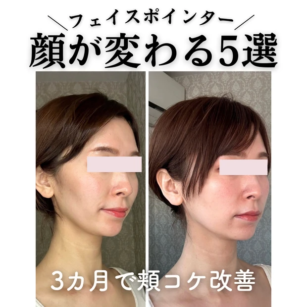 【フェイスポインターで顔が変わる5選】ほうれい線・小顔・エラ張りにアプローチ!毎日3分で“−5歳印象”習慣
