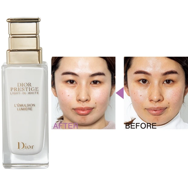 見た目印象が別人級に!? ディオールの薬用ホワイトニング乳液を約1カ月…