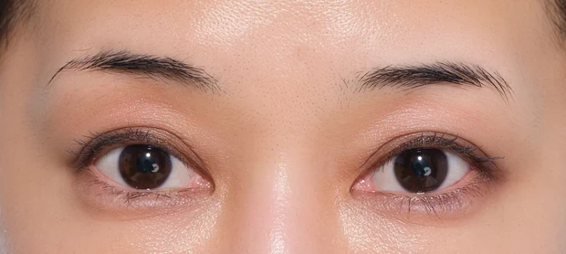 細眉タイプによくあるお悩み解消法