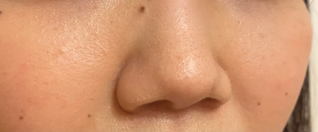 【マミ様のお墨付き！】人生初スノーピールに感動【完全無加工すっぴんレポ】_2_1