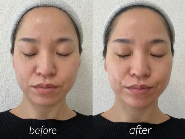 ルルンプレシャス GREEN ビフォーアフター