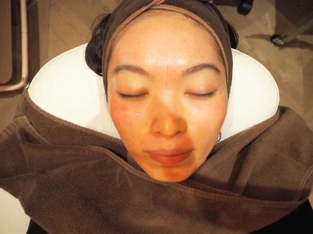 【話題の美容医療レポ】ダーマペンより効果あり？！水光注射を体験_4_1