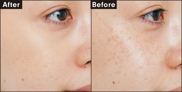 パーフェクトカバー ファンデーション MC n N10 カバー力を検証