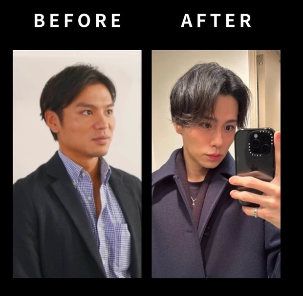 【アラサー男性体験談】メンズ美容の第一歩。VISIAで知る今のリアルな肌状態_1