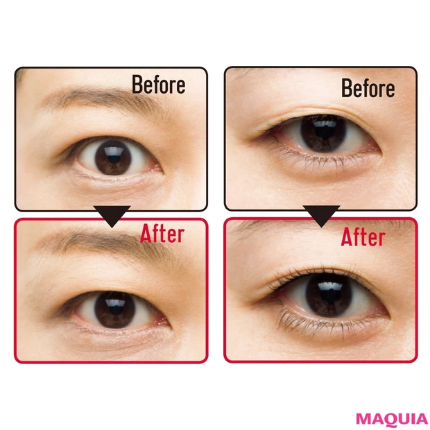 「まつ毛が下向きに生えています……」ニッチな目悩みをプロが解決！