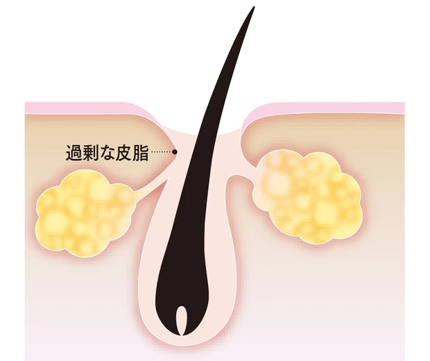 【トラブル肌のメカニズム】シミ、シワ、たるみ、乾燥、毛穴etc.におすすめのコスメ_1_42