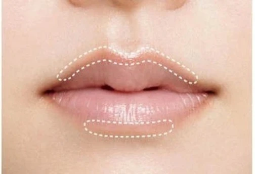 欲張りオーバーリップ BEFORE