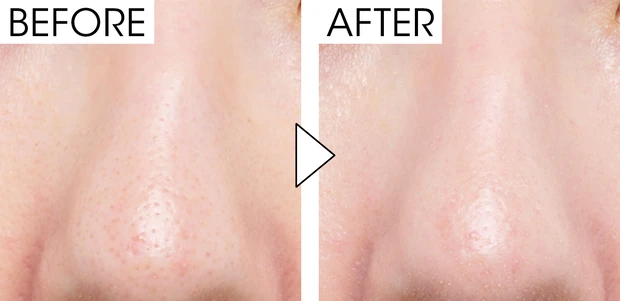 マキア　毛穴ケア　おすすめ　ゲラン　パリュール ゴールド スキン ダブル ヴェール プライマー