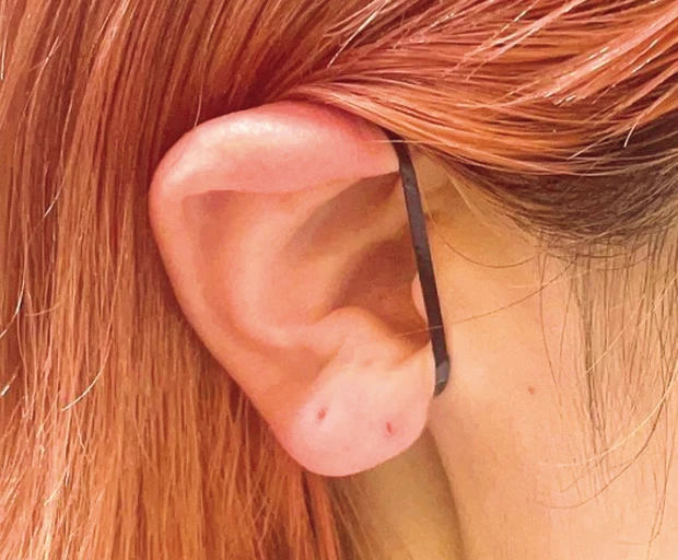 耳ツボ美容の効果は？ ツボの位置を解説 PhotoGallery_1_8