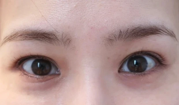 【目のクマの消し方】インフルエンサーおすすめのクマに効くアイケアは?_クマの改善を期待できるドクターズコスメ_2