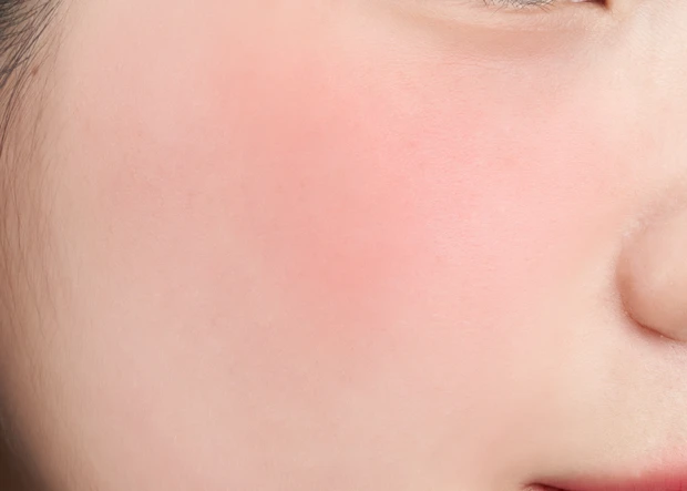 CR04 セブンティーン チーク