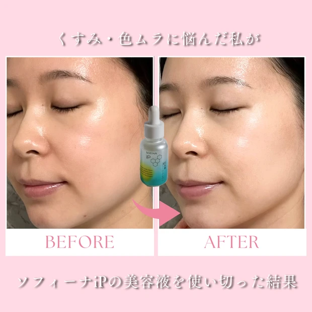 【ソフィーナiP】角層トーニングセラムを1本使い切り｜くすみ・色ムラへの変化を本音レビュー