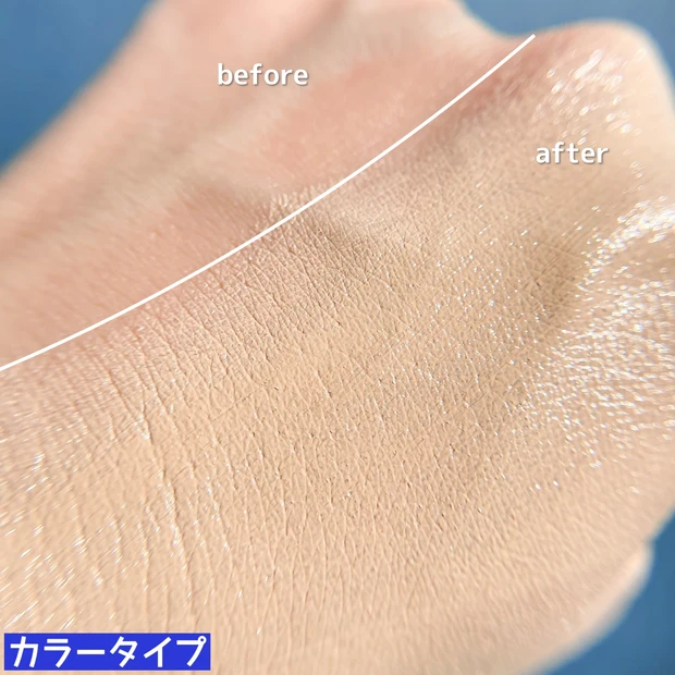 【深刻な敏感症状に】皮膚の専門家監修のお守り保護バームがおすすめ！_6_2