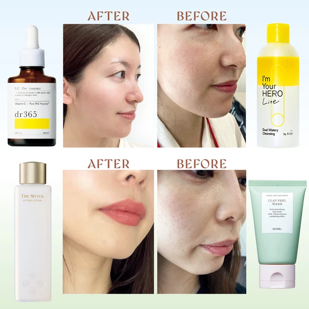 【皮脂毛穴タイプ】美容プロ伴走「30日間毛穴ケアマラソン」の結果を発表！