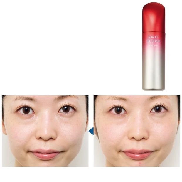 アスタリフトの美容液1本使い切った結果は？ 30日間お試しレポートを公開